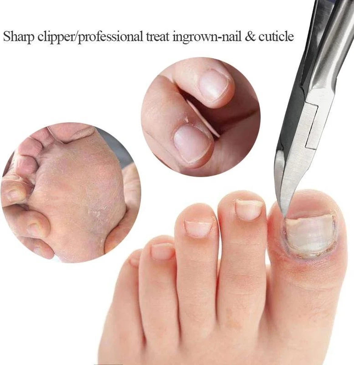 Professionele Nagelschaar Voor Ingegroeide Teennagels- Manicure - Pedicure - Voetverzorging 5 Professionele Nagelschaar Voor Ingegroeide Teennagels- Manicure - Pedicure - Voetverzorging - Afbeelding 3