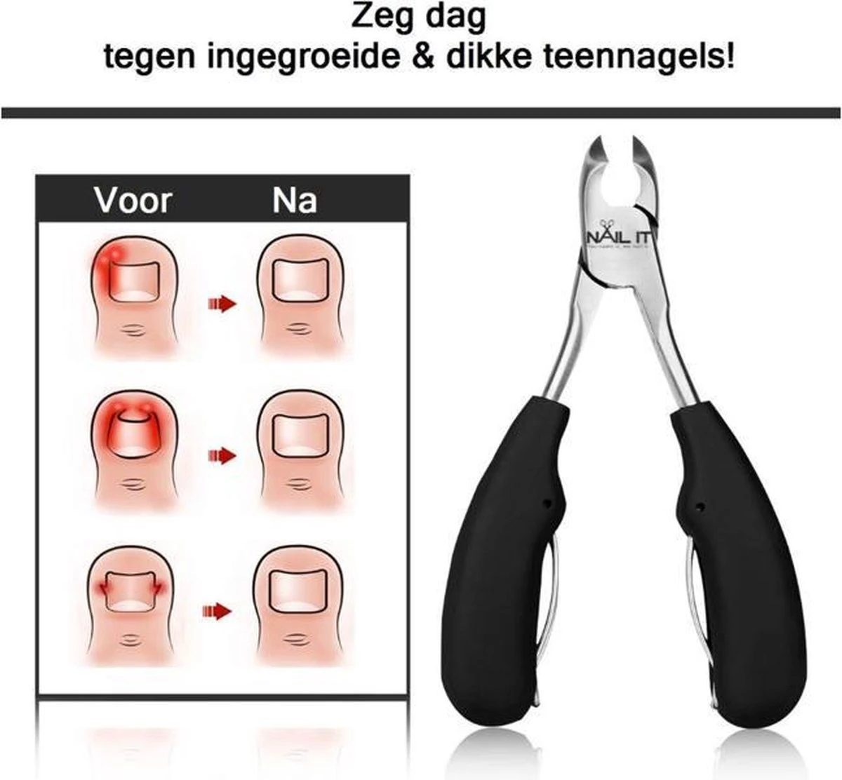 Nail It Nageltang Met Gebogen Bek + Gratis Vijl| Nagelknipper| Teennagelknipper| Nagelschaar| Ingegroeide Teennagels| Dikke Nagels| Nagelknipper Set| Pedicure Set| Cadeau Tip 2023 - Afbeelding 4