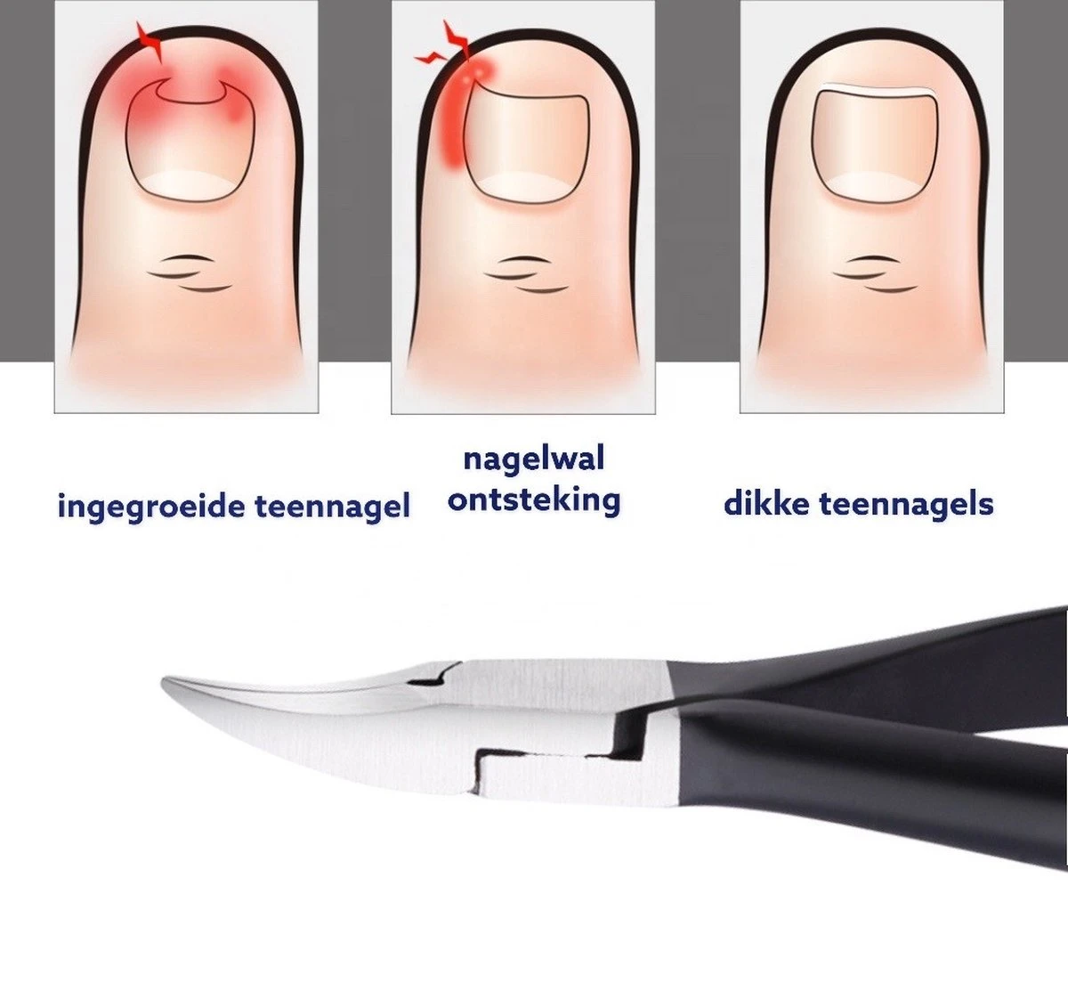Medies - Professionele Zware Nageltang Voor Teennagels | Nagelknipper Teennagels | Ingegroeide Teennagel | Kalknagel | Harde Teennagels | Nagelschaar | Pedicure - Ingebouwde Veren - Afbeelding 6