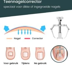 7-Delige Pedicure Set - Nagelverzorging - Nagelset Starterset - Ingegroeide Teennagel - Kalknagelproducten - Pedicuresets - RVS 17 7-Delige Pedicure Set - Nagelverzorging - Nagelset Starterset - Ingegroeide Teennagel - Kalknagelproducten - Pedicuresets - RVS -Pink Gellac Shop 1200x1130 35
