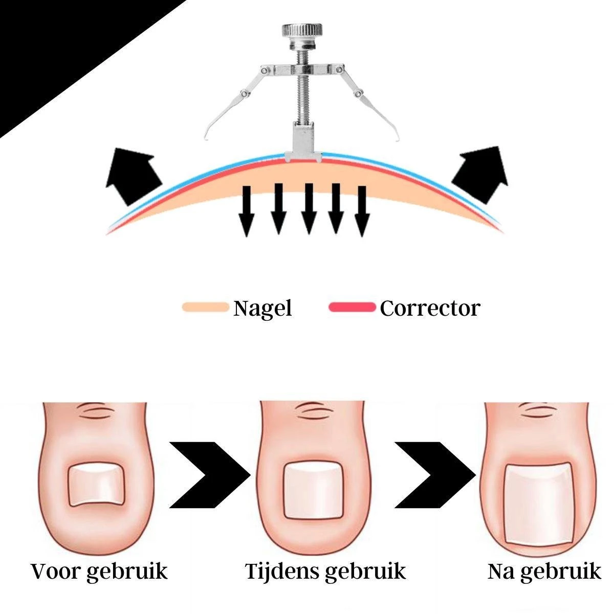 Merkloos STARMAN 7-delige Pedicure En Manicure Set - Nagelknipper - Pedicureset - Nagelvijl - Nageltang - Kalknagel - Teennagelknipper - Afbeelding 6