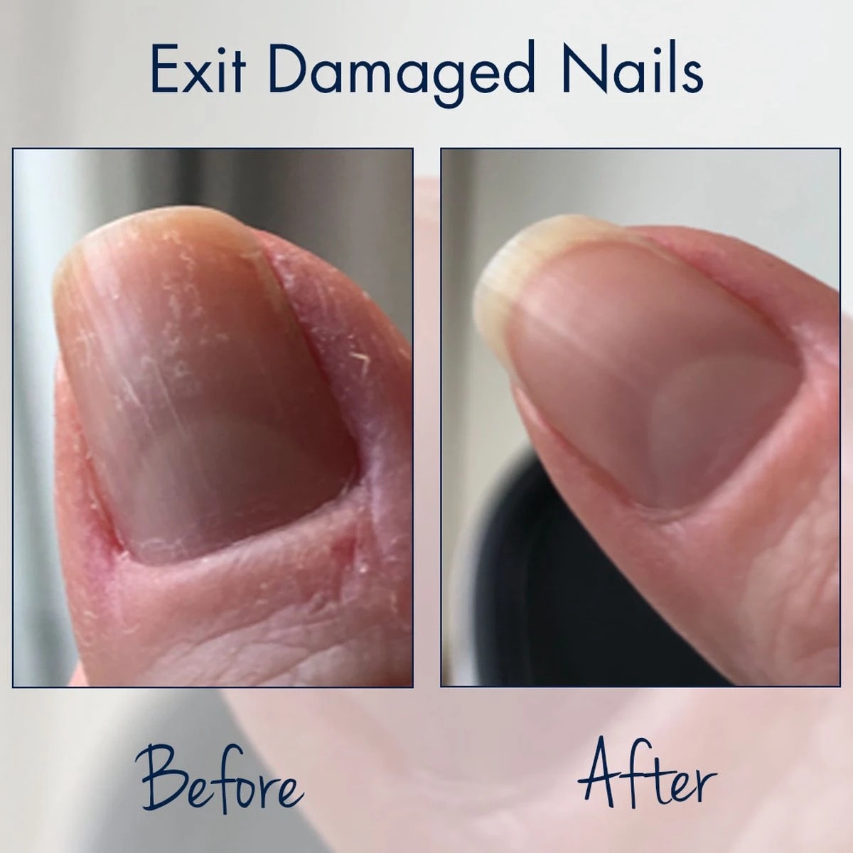 Herome Combi-Pack Exit Damaged Nails & Nagelverharder Extra Sterk (Nail Hardener Extra Strong) - Herstelt Beschadigde Nagels En Zorgt Voor Ijzersterke Nagels - 7ml. & 10ml. - Afbeelding 3
