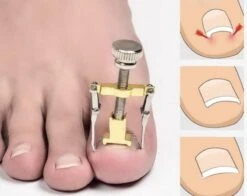 Merkloos Ingegroeide Teennagel Lifter / Corrector | Ingegroeide Vingernagel Vingernagels Teennagels Correctie | Nagel Corrector / Lift